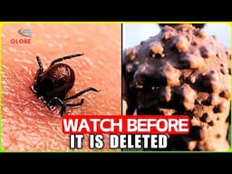 They Warned NOT GET TOO CLOSE! World’s Most Dangerous INSECTS You Won’t Believe Exist! - Documentary