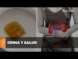 La orina como indicador de salud: atención a los cambios de color | Salud 180