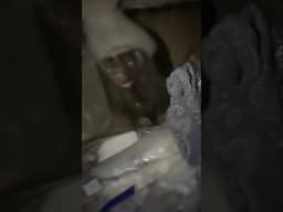 Rabid Skunk Attacks Me in My Tent