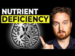 The #1 Nutrient Deficiency In Memory Loss
