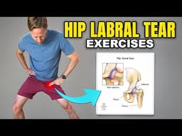 Hip Labral Tear Exercises