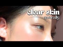 How I Cleared My Skin In 8 Weeks *naturally*