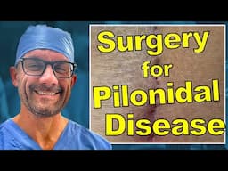 8 Different Surgeries for Pilonidal Disease