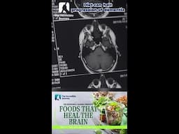 Unlock the Secret to Brain Health with Every Bite!