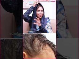Hair Thinning-க்கு இதுதான் Reason ❗ - Dr. Sheik Arifa Aesthetic Cosmetologist