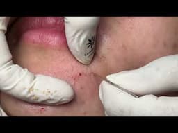 Linhmydangspa (14/4/2025)