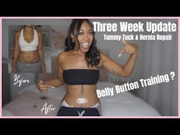 3 Week Tummy Tuck Update | belly button training