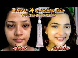 My Skin Was Glowing… Then THIS Happened After Tretinoin 😳