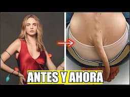 20 Famosos Con Extrañas Deformidades En El Cuerpo
