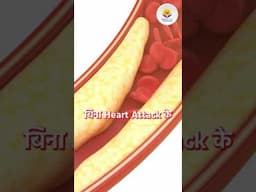 Heart Disease The Silent Killer ! Dr. D K Jhamb #cardiologist