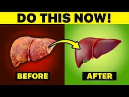 Eating These 10 Foods Destroys Liver Fat FAST! | Fatty Liver Cleansing