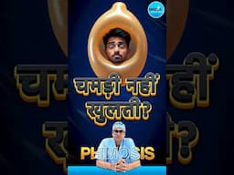 लिंग की चमड़ी टाइट? | सेक्स में दर्द क्यों हो रहा है? | Don’t Ignore Foreskin Issues! Know the Cure!