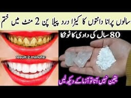This magical teeth whitening remedy will whiten teeth in just 2 minutes|best teeth whitening remedy