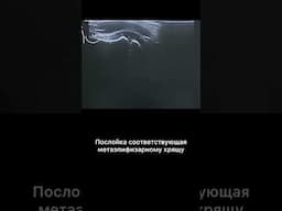 #узи #метафиз