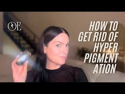 HOW TO GET RID OF HYPERPIGMENTATION | MICROCURRENT, COLLAGEN & MORE