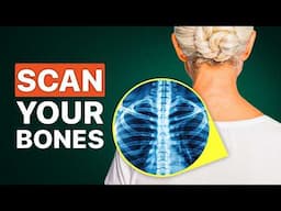 Can You Get Radiation From A Bone Scan? Everything You Need To Know About DEXA Scans!