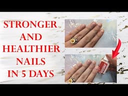 HEALTHIER, SMOOTHER, LESS BRITTLE NAILS IN JUST 5 DAYS | Essie to the Rescue Nail Treatment