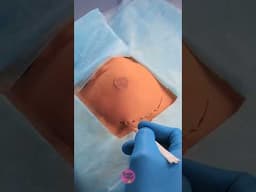 Shocking Truth Behind Pricey Medical Procedures! 😱🦷 #medicalhacks
