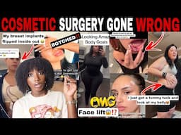 MERCY!😱 PLASTIC SURGERY GONE WRONG: FAILED COSMETIC TRAUMA THAT WENT HORRIBLY WRONG | BOTCHED