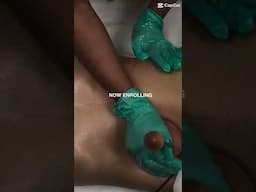 Post Op Manual Lymphatic Drainage Class | 18 NCBTMB Credits | Enroll