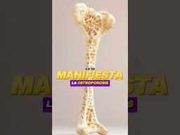 🚨 Así se 🩻 MANIFIESTA la OSTEOPOROSIS💀