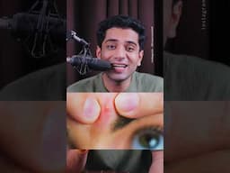 Yaha se pimple mat nikalna #shivammalik ￼