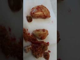 HUNDREDS OF BLADDER STONES from a dog! #vetmed #dogs #pets #surgery #cats