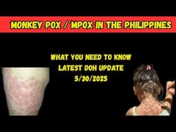 Are You at Risk of Contracting Mpox Monkey Pox in the Philippines?