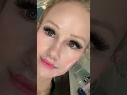 My Two Week Lip Lift Transformation