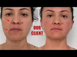 BEAUTIFUL LIFTING-DRAINAGE Massage with working Massage techniques
