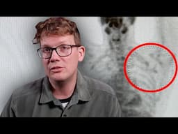 I Still Don't Have Cancer (and I'm Still Scared)