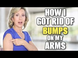 I Got Rid of the Little Bumps on My Arms - No More Keratosis Pilaris! Here's How!