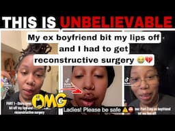 MERCY!😱 HER EX BOYFRIEND BIT HER LIPS OFF AND SHE HAD TO GET RECONSRUCTIVE SURGERY | VIRAL TIKTOK