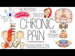 Understanding Chronic Pain (Including Treatment)