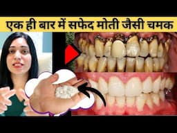 दांतो को एक ही बार में सफ़ेद मोती जैसे चमकने का घरेलु तरीका | Home Remedies For  Teeth Whitening