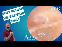 Satisfying Microsuction Compilation: 4 Epic Wax Plug Extractions! - EP1150