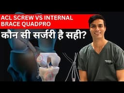 ACL Screw vs Internal Brace Quadpro – कौन सी सर्जरी है सही?