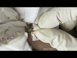 Big Cystic Acne Blackheads Extraction Blackheads & Milia, Whiteheads Removal Pimple Popping