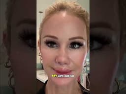 My Post Lip Lift Recovery Update