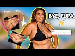 FUPA Surgery After 100 Pound Weight Loss