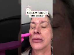 Smile Without the Lines!