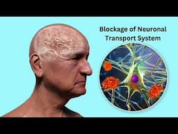 Molecular Mechanisms of Alzheimer's