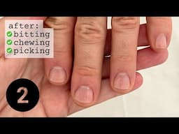 How to re-start your nails (after falling off the wagon) WEEK 2