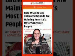 The Xylazine Crisis: A New Threat in the Fentanyl Epidemic