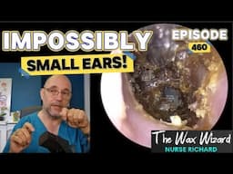 IMPOSSIBLY SMALL EARS! Episode 460 (My hardest procedure of the year so far!)