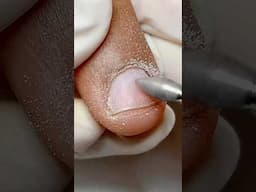 Satisfying Cuticle Cutting #shorts