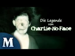 "Charlie No Face" - Raymond Robinson - Der Mann ohne Gesicht