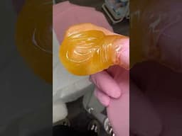 SUGARING | SUGAR WAX #waxing #sugarwaxing #sugaring #hairremoval