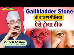 Gallbladder Stone पीलिया ऐसे होगा ठीक || COMPLICATIONS OF GALL STONES