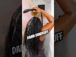 Let’s talk about dandruff and what I do to reduce it. #dandruff #naturalhaircare